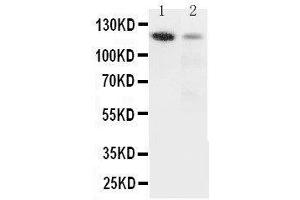 Anti-Integrin alpha 3 antibody, Western blotting Lane 1: Rat Heart Tissue Lysate Lane 2: HELA Cell Lysate (ITGA3 抗体  (N-Term))