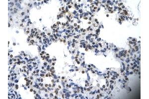 Immunohistochemistry (IHC) image for anti-Interleukin Enhancer Binding Factor 2, 45kDa (ILF2) (C-Term) antibody (ABIN2776419)