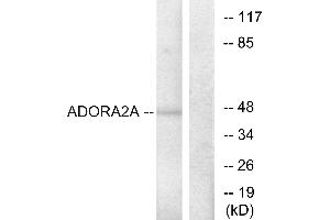 Immunohistochemistry analysis of paraffin-embedded human brain tissue using ADORA2A antibody. (Adenosine A2a Receptor 抗体  (Internal Region))