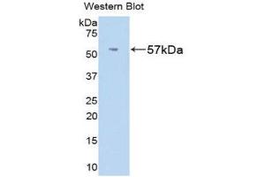Western Blotting (WB) image for anti-Fibrinogen beta Chain (FGB) (AA 33-479) antibody (ABIN1174356) (Fibrinogen beta Chain 抗体  (AA 33-479))