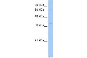 NSDHL antibody used at 2. (NSDHL 抗体)