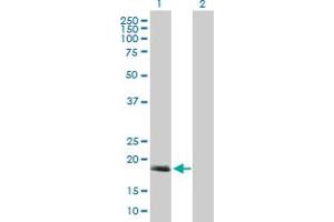 Western Blot analysis of C17orf49 expression in transfected 293T cell line by C17orf49 MaxPab polyclonal antibody. (C17orf49 抗体  (AA 1-172))