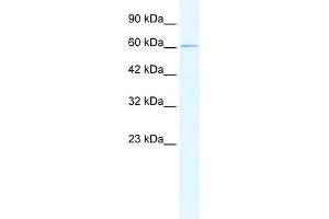 WB Suggested Anti-GABRD Antibody Titration:  0. (GABRD 抗体  (N-Term))