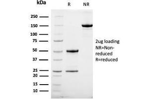 SDS-PAGE Analysis Purified HER-2 Mouse Monoclonal Antibody (HRB2/258). (ErbB2/Her2 抗体  (Extracellular Domain))