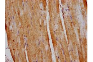 IHC image of ABIN7150742 diluted at 1:400 and staining in paraffin-embedded human skeletal muscle tissue performed on a Leica BondTM system. (DUSP13 抗体  (AA 1-198))
