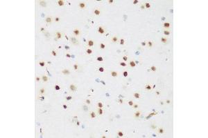 Immunohistochemistry of paraffin-embedded mouse brain using CSRNP1 antibody at dilution of 1:200 (40x lens). (AXUD1 抗体)