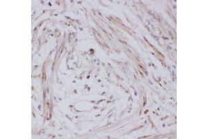 Immunohistochemistry (IHC) image for anti-Solute Carrier Family 2 (Facilitated Glucose Transporter), Member 4 (SLC2A4) (AA 333-509) antibody (ABIN3043929)