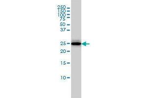 Image no. 3 for anti-Regulator of G-Protein Signaling 2 (RGS2) (AA 111-211) antibody (ABIN465968) (RGS2 抗体  (AA 111-211))