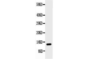 Anti-Estrogen Inducible Protein pS2 antibody, Western blottingWB: Rat Stomach Tissue Lysate (TFF1 抗体  (Middle Region))