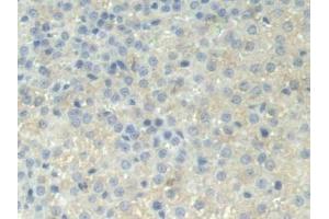 IHC-P analysis of Rat Adrenal gland Tissue, with DAB staining. (PPOX 抗体  (AA 9-300))