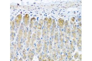 Immunohistochemistry of paraffin-embedded Mouse stomach using TAMM41 Polyclonal Antibody at dilution of 1:100 (40x lens). (TAM41 抗体)