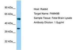 Image no. 1 for anti-Family with Sequence Similarity 49, Member B (FAM49B) (AA 22-71) antibody (ABIN6750181) (FAM49B 抗体  (AA 22-71))