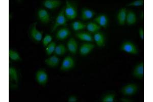 Immunofluorescence staining of A549 cells with ABIN7155179 at 1:200, counter-stained with DAPI. (PDE9A 抗体  (AA 426-533))