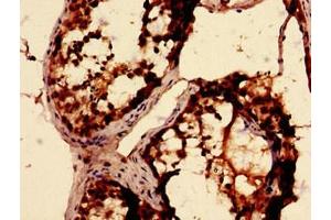 Immunohistochemistry analysis of human testis tissue using ABIN7168095 at dilution of 1:100 (Ribokinase 抗体  (AA 2-322))