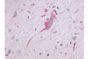 Anti-LPHN1 antibody IHC of human brain, neurons and glia. (Latrophilin 1 抗体  (N-Term))