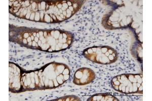 Immunoperoxidase of monoclonal antibody to ARFIP1 on formalin-fixed paraffin-embedded human colon. (ARFIP1 抗体  (AA 1-101))