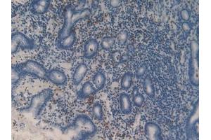 Immunohistochemistry (IHC) image for anti-Matrix Metallopeptidase 9 (Gelatinase B, 92kDa Gelatinase, 92kDa Type IV Collagenase) (MMP9) (AA 213-399) antibody (ABIN7432013)