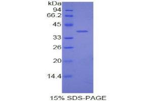 SDS-PAGE analysis of Dog Apolipoprotein C1 Protein. (APOC1 蛋白)