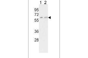 Western blot analysis of CYP7A1 Antibody in K562(lane 1), HepG2(lane 2) cell line lysates (35ug/lane) (CYP7A1 抗体  (C-Term))