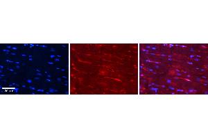Rabbit Anti-CSK Antibody Catalog Number: ARP52042_P050 Formalin Fixed Paraffin Embedded Tissue: Human Heart Tissue Observed Staining: Cytoplasm in endothelial cells in capillaries Primary Antibody Concentration: 1:100 Other Working Concentrations: N/A Secondary Antibody: Donkey anti-Rabbit-Cy3 Secondary Antibody Concentration: 1:200 Magnification: 20X Exposure Time: 0. (CSK 抗体  (Middle Region))