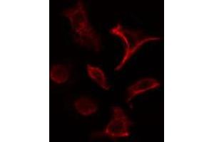 ABIN6266830 staining HeLa cells by IF/ICC. (COL4A1 抗体)
