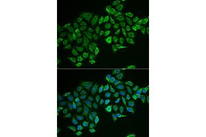 Immunofluorescence analysis of MCF-7 cells using RHOD antibody (ABIN5973862). (RHOD 抗体)