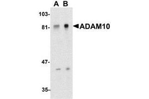 Western blot analysis of ADAM10 in Jurkat whole cell lysate with AP30017PU-N ADAM10 antibody at (A) 1 and (B) 2 μg/ml. (ADAM10 抗体  (C-Term))