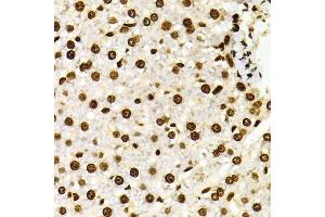 Immunohistochemistry of paraffin-embedded Rat liver using DiMethyl-Histone H3-K27 antibody. (Histone 3 抗体  (H3K27me))