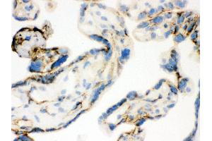 Anti- TGM2 Picoband antibody, IHC(F) IHC(F): Human Placenta Tissue (Transglutaminase 2 抗体  (N-Term))