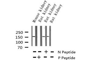 Western blot analysis of Phospho-VEGFR2 (Tyr1214) expression in various lysates (VEGFR2/CD309 抗体  (pTyr1214))