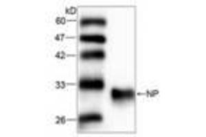Image no. 1 for anti-Purine Nucleoside Phosphorylase (PNP) (AA 68-289) antibody (ABIN791487) (PNP 抗体  (AA 68-289))