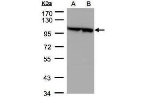 WB Image Sample(30 μg of whole cell lysate) A:293T B:A431, 7. (EEF2 抗体)