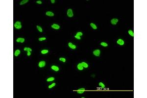 Immunofluorescence of monoclonal antibody to CBX3 on HeLa cell. (CBX3 抗体  (AA 1-183))