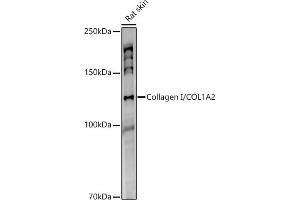 Western blot analysis of extracts of Rat skin, using Collagen I/COL1 antibody (1059) at 1:1000 dilution. (COL1A2 抗体)