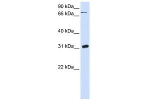 UPP1 antibody used at 1 ug/ml to detect target protein. (UPP1 抗体  (N-Term))