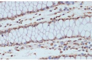 Immunohistochemistry (Paraffin-embedded Sections) (IHC (p)) image for anti-Cyclin-Dependent Kinase 1 (CDK1) (pTyr15) antibody (ABIN7265020)