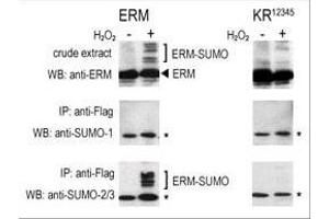 COS-7 cells were transfected for 24 hrs with a plasmid expressing FLAG-ERM (left panels) or FLAG-ERM K (right panels). (SUMO1 抗体  (C-Term))