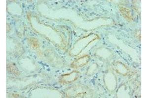 Immunohistochemistry of paraffin-embedded human kidney tissue using ABIN7145824 at dilution of 1:100 (BRD9 抗体  (AA 338-597))