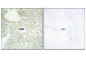 Immunohistochemistry (IHC) image for anti-Transforming Growth Factor, beta Receptor II (70/80kDa) (TGFBR2) (pSer225), (pSer250) antibody (ABIN1847404) (TGFBR2 抗体  (pSer225, pSer250))
