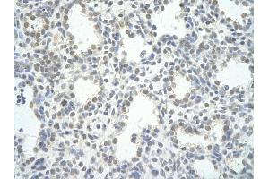 Rabbit Anti-PPP1R8 antibody   Paraffin Embedded Tissue: Human Lung cell Cellular Data: alveolar cell of renal tubule Antibody Concentration: 4. (PPP1R8 抗体  (N-Term))
