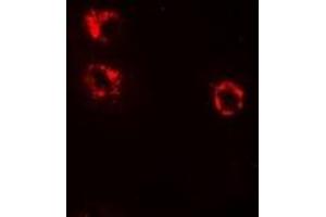 Immunofluorescent analysis of Anamorsin staining in HepG2 cells. (CIAPIN1 抗体)