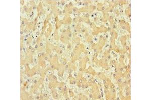 Immunohistochemistry of paraffin-embedded human liver tissue using ABIN7148261 at dilution of 1:100 (Collagen, Type VI, alpha 6 (COL6A6) (AA 430-982) 抗体)