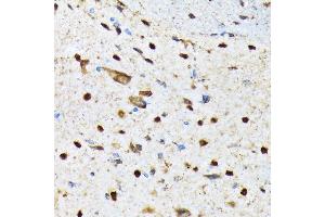 Immunohistochemistry of paraffin-embedded mouse spinal cord using CAMKIV Rabbit mAb (ABIN7266021) at dilution of 1:100 (40x lens). (CAMK4 抗体)