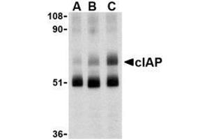 Western blot analysis of c-IAP in human lung lysate with AP30228PU-N c-IAP antibody at 1 (lane A), 2 (lane B), and 4 (lane C) μg/ml, respectively. (BIRC2 抗体  (C-Term))