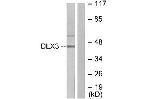 Immunohistochemistry analysis of paraffin-embedded human heart tissue using DLX3 antibody. (DLX3 抗体  (Internal Region))