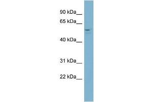 Human NCI-H226; WB Suggested Anti-ACD Antibody Titration: 0. (ACD 抗体  (Middle Region))