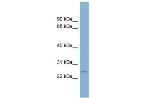 WB Suggested Anti-CD160 Antibody Titration:  0. (CD160 抗体  (Middle Region))