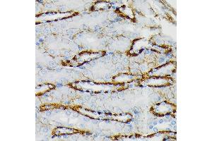 Immunohistochemistry (IHC) image for anti-Glutamate Receptor, Ionotropic, Kainate 2 (GRIK2) antibody (ABIN7267415)