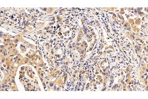 Immunohistochemistry (IHC) image for anti-Interleukin 10 Receptor, alpha (IL10RA) (AA 132-235) antibody (ABIN7433870)