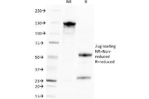 SDS-PAGE Analysis Purified CMV-p65 Mouse Monoclonal Antibody (CMV100). (CMV p65 抗体)